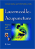 Laserneedle Acupuncture